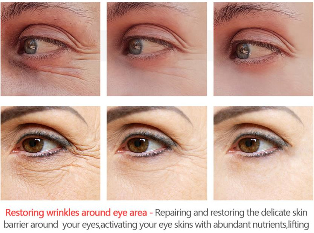 MISSHA Moist Lab Eye Cream 30m - Eye Cream Peptide บทวิจารณ์และราคา